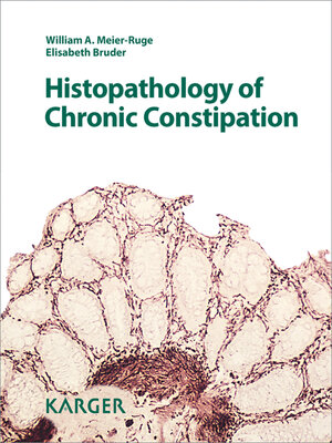 cover image of Histopathology of Chronic Constipation